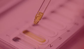 Pipette auf Teststreifen